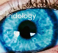 Iridology Explained with our Naturopath & Nutritionist Cassandra